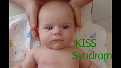 Infografika: KISS syndrom - hlavní pojmy a léčba
