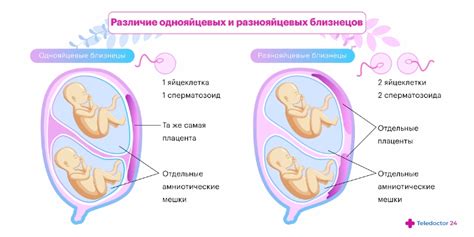 Ilustrace znázorňující vznik jednovaječných a dvojvaječných dvojčat