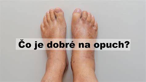 Infografika: Jak fungují otoky nohou po porodu a co dělat