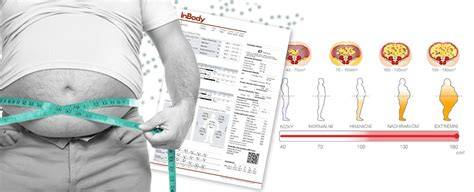 Infografika: rozdíly mezi volnou kůží, břišním tukem a patologickou obezitou