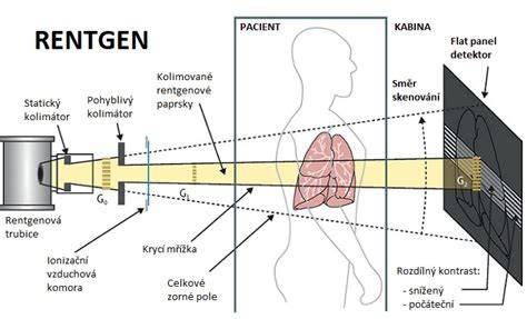 schéma dávky záření pro různé typy vyšetření (rentgen hrudníku, RTG končetiny, CT břicha, nukleární medicína)