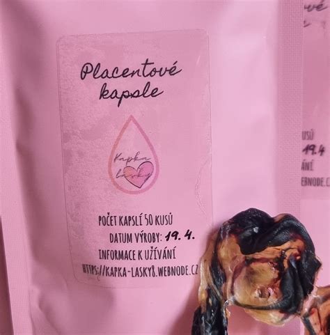 schéma znázorňující pupečník, placentu a plodové obaly
