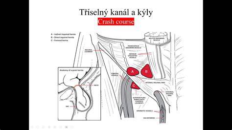 Schéma tříselné kýly