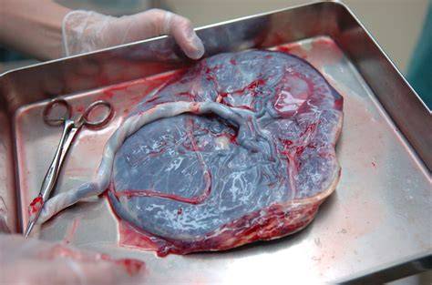 Infografika: Placenta u přežvýkavců a kotyledonová placenta