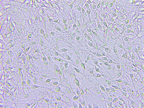 mikroskopické zobrazení spermií