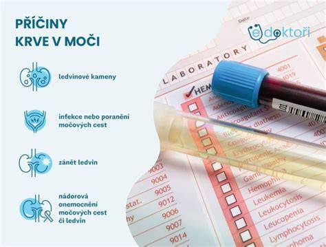 Infografika: Jak funguje ledvinný filtr a proč může dojít ke krev v moči během těhotenství