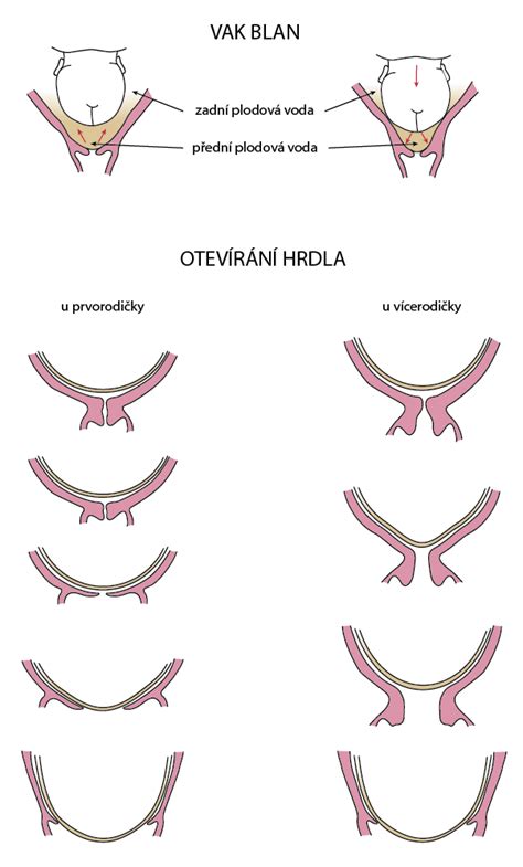 schéma znázorňující pokles břicha před porodem