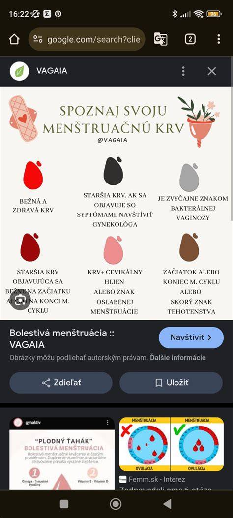 Infografika: Zobrazenie hlavných príčin zmeny farby spermatu a čo robiť