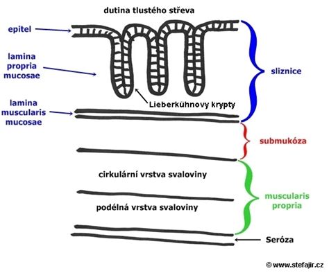 Schema znázorňující uskřinutou kýlu s útlakem cév a střeva.