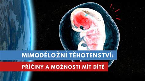 Infografika zobrazující různé rizikové faktory pro mimoděložní těhotenství.