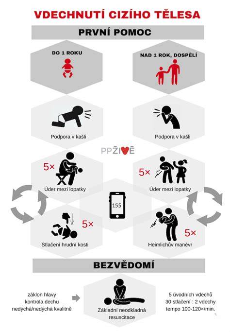 Infografika: První pomoc při vdechnutí cizího tělesa u kojenců