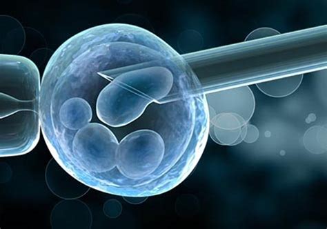 Ilustrace procesu IVF a PGD