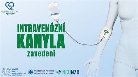 Ilustrace znázorňující zavedení kanyly do žíly na hlavě dítěte s medicínským personálem.