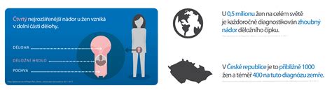 Infografika znázorňující HPV virus a jeho vliv na buňky děložního čípku.