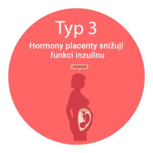Infografika: Mechanismus vzniku těhotenské cukrovky a placentární hormony