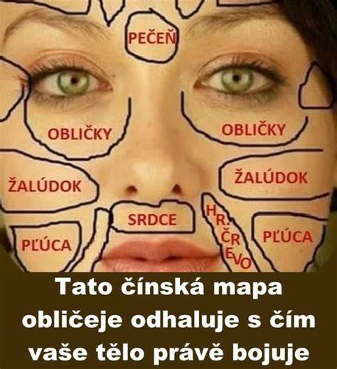 mapa těla s typickými lokalizacemi vyrážek