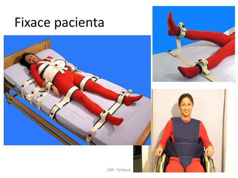 Schéma znázorňující princip fixace pacienta na páteřní desce