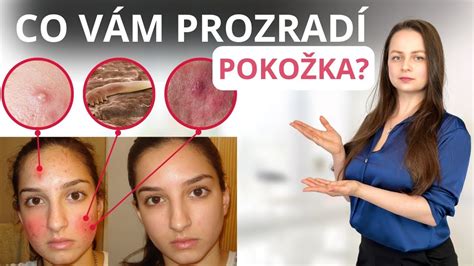 Ilustrace správného nanášení krému na pokožku v oblasti plenek.
