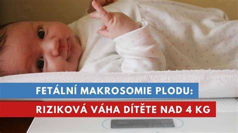 Infografika: Makrosomie plodu - rizika, diagnostika a management
