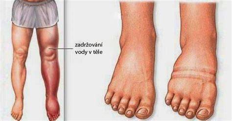 Infografika: Jak funguje odvodnění nohou po porodu