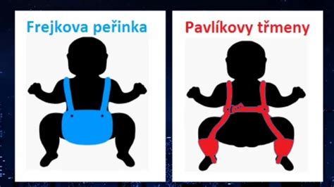 Infografika: schéma kyčelního kloubu a abdukční pomůcky (Pavlíkovy třmeny, Frejkova peřinka)