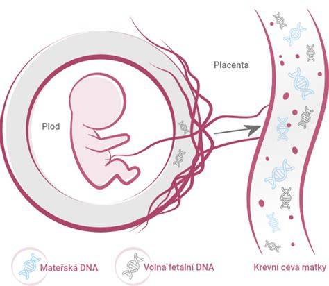 Infografika: princip Prenascan a průběh testu z odběru krve matky