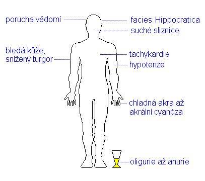 Infografika: Schéma fontanel a známky dehydratace u kojenců