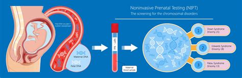 Diagram NIPT vs. tradiční screening: princip a rozdíly