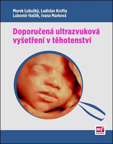 Schéma rutinních ultrazvukových vyšetření v těhotenství