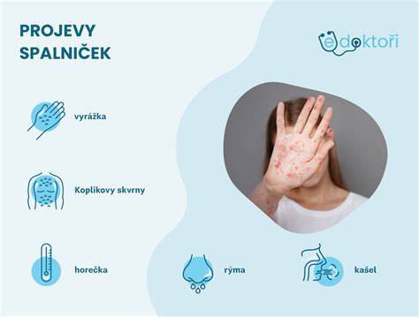 Infografika: Jak se šíří spalničky a kdy hrozí riziko pro těhotné