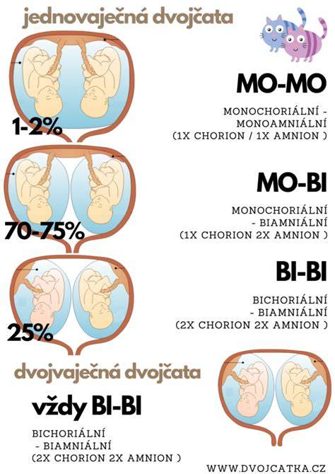 Infografika: Typy dělení jednovaječných dvojčat a jejich placenty