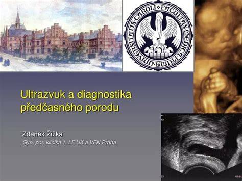 Infografika: Diagnostika a léčba předčasného porodu