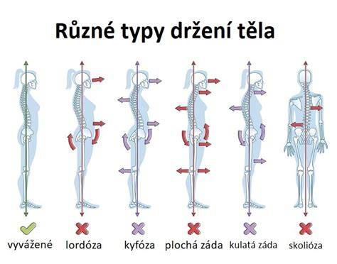 Infografika: Jak rozpoznat asymetrii hlavy a držení těla u kojence
