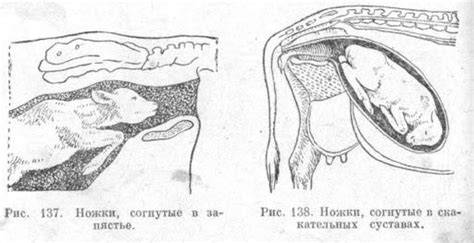 Infografika: Příznaky předčasného porodu a stádia zralosti plodu