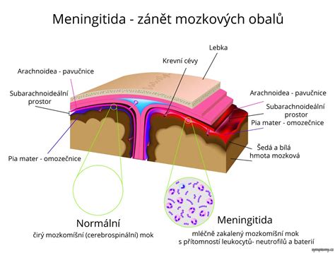 Infografika smestruktury mozkových plen a jejich vztahu k meningitidě