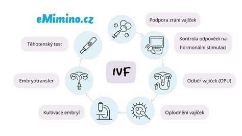 Infografika: Krok za krokem proces darování spermií