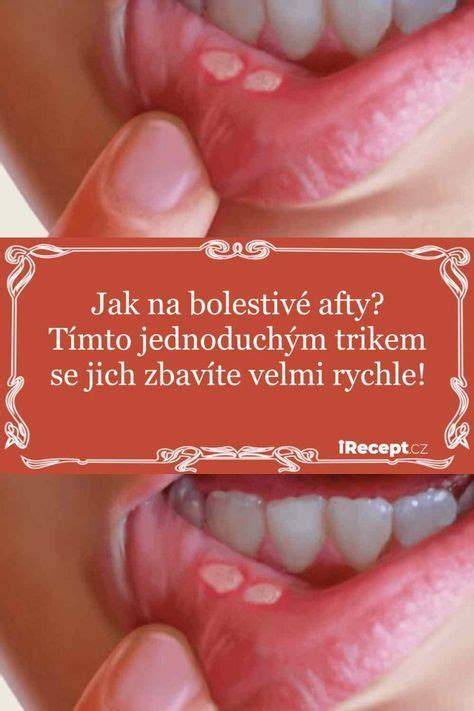Infografika: Vzor afty a její umístění v dutině ústní