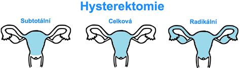 grafické znázornění ženských reprodukčních orgánů s vyznačením dělohy, vaječníků a vejcovodů
