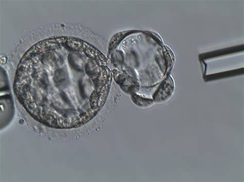 PGT a výběr embryí s vyváženým chromozomálním složením
