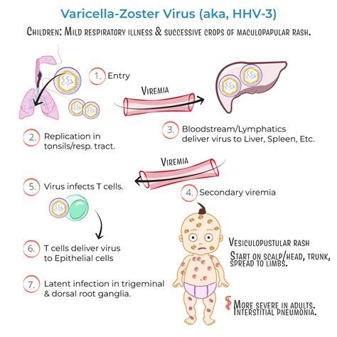 Infografika: Průběh varicella-zoster viru a riziko přenosu na novorozence