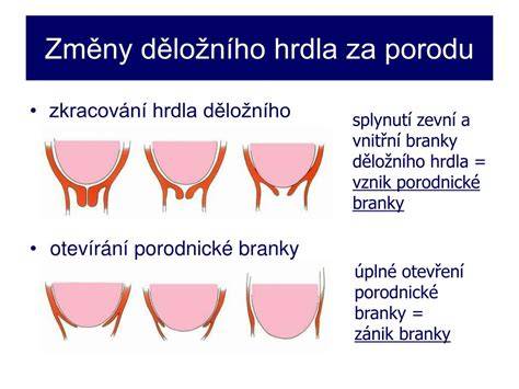 Schéma otevření děložního hrdla a postupnosti porodní branky