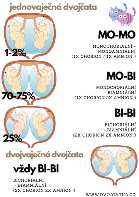 ultrazvukový nález jednovaječných dvojčat