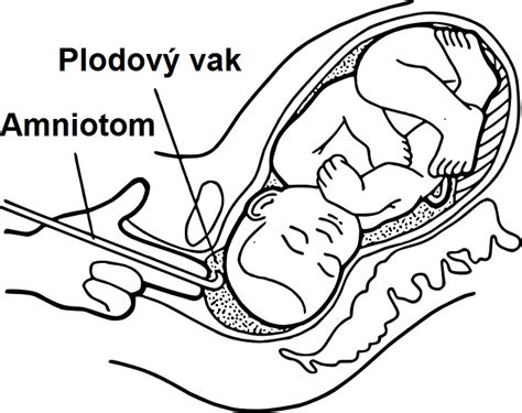 schematické znázornění plodové vody v děloze a plodového obalu