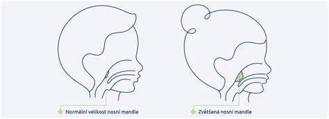 Schéma Waldeyerova lymfatického okruhu a umístění nosní mandle (adenoidů)