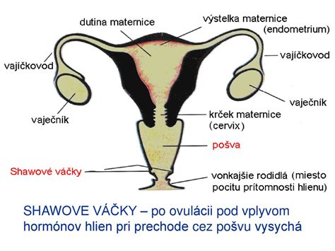 schéma anatomických anomálií dělohy