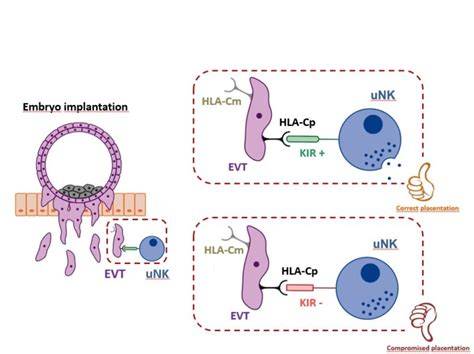 Maternal Killer Immunoglobulin like Receptors are predictive of live birth rate