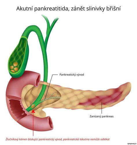 Infografika: Anatomie slinivky a umístění v břišní dutině