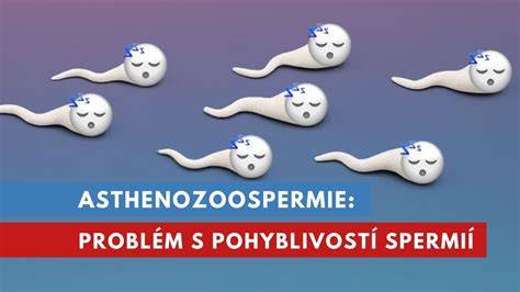 Infografika s ukázkou spermiogramu: podíly pohyblivých, neprogresivně pohyblivých a nepohyblivých spermií
