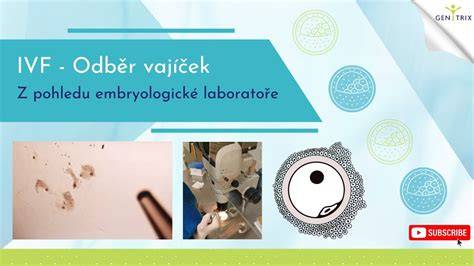 Infografika: Průběh IVF, 1) stimulace, 2) odběr vajíček, 3) oplodnění, 4) kultivace, 5) transfer, 6) kryokonzervace