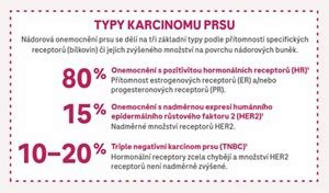 schéma zobrazovacích metod pro diagnostiku nádorů prsu v těhotenství